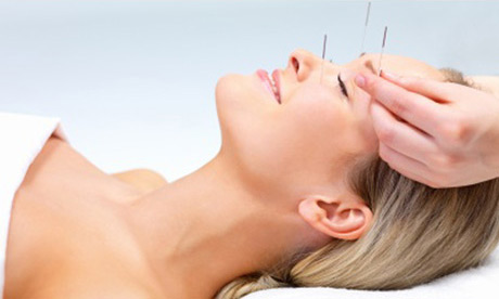 tn_facial-acupuncture-2